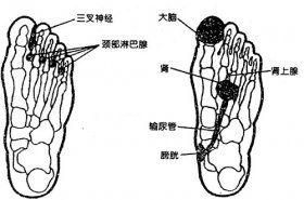 三叉神经痛足部穴位疗法